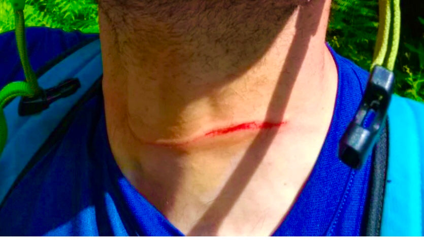 neckguard collare di protezione per il collo