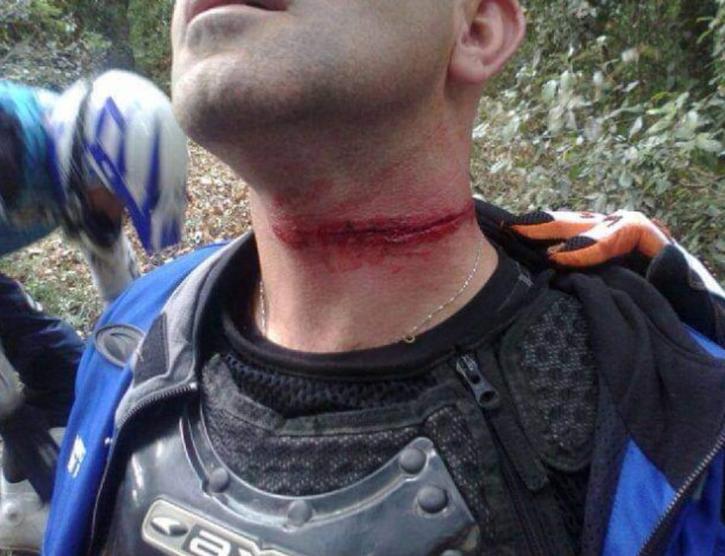 Collare di protezione Enduro Bike MTB