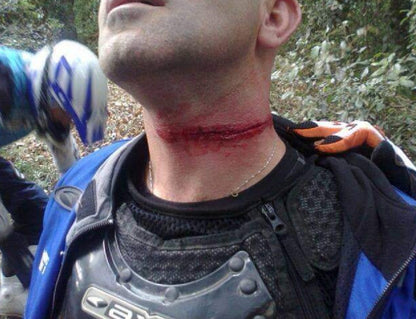 Collare di protezione Enduro Bike MTB